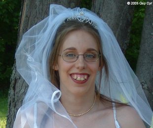 Marie-Hélène Cyr - Before orthodontic treatments and orthognathic surgeries (June 4, 2005)